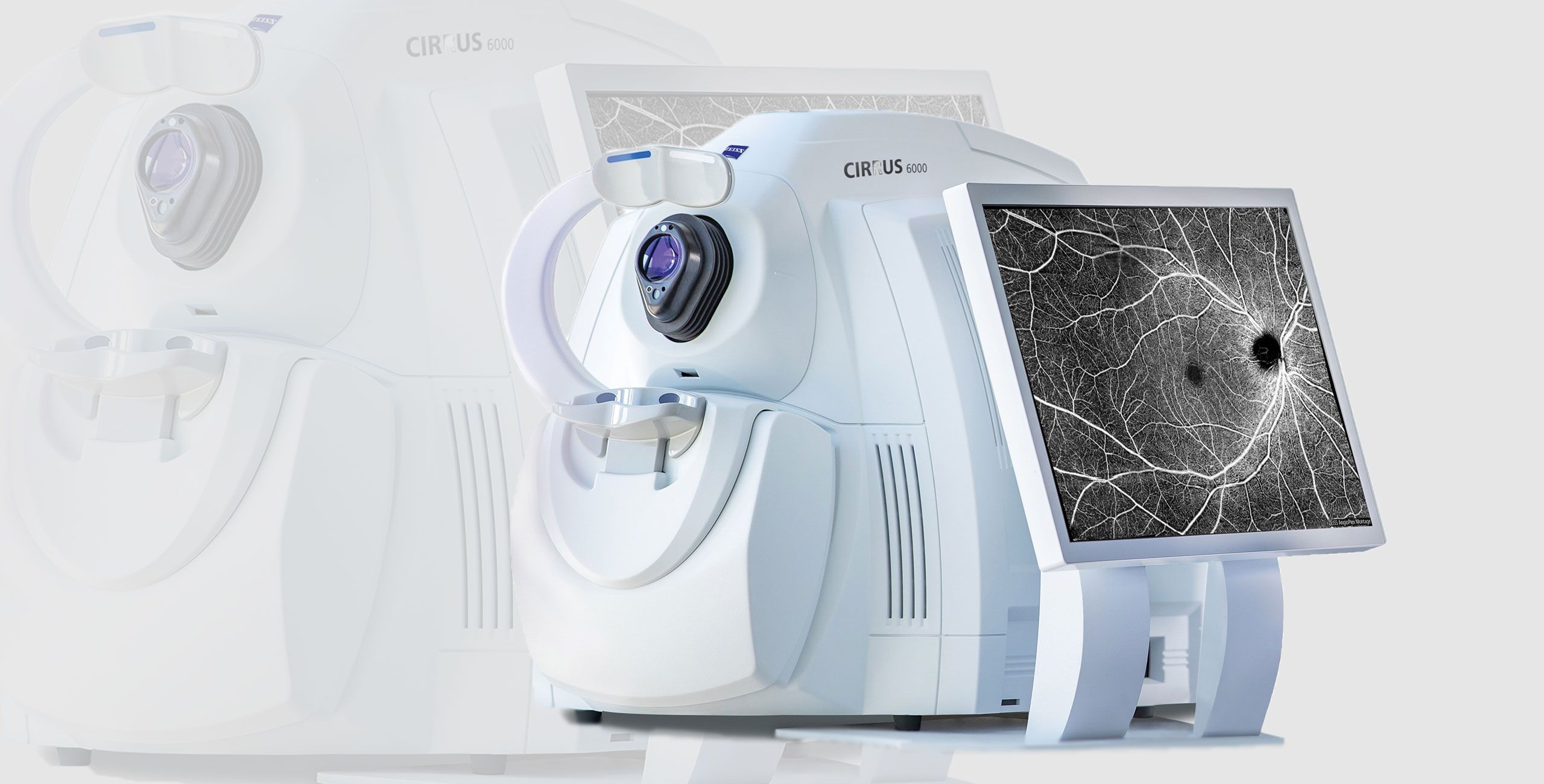 La Tomographie à Cohérence Optique - Centre ophtalmologique COSS Paris 5