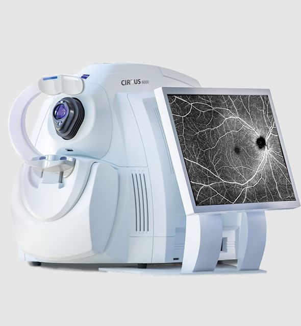 OCT : la Tomographie à Cohérence Optique - Centre ophtalmologique COSS à Paris 5